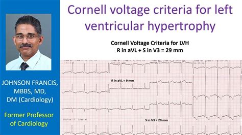 cornell voltage test for lvh